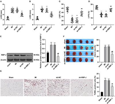 Blockade of the Notch Signaling Pathway Promotes M2 Macrophage Polarization to Suppress Cardiac Fibrosis Remodeling in Mice With Myocardial Infarction